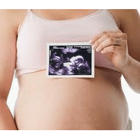 УЗД при вагітності