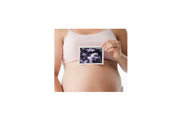 УЗД при вагітності - NaVolyni.com