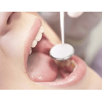 Ортопедичне лікування  зубів