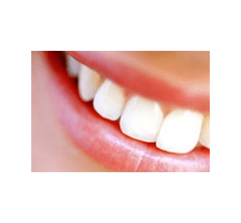 Художня реставрація зубів