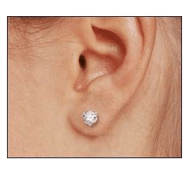 Проколювання мочки вуха