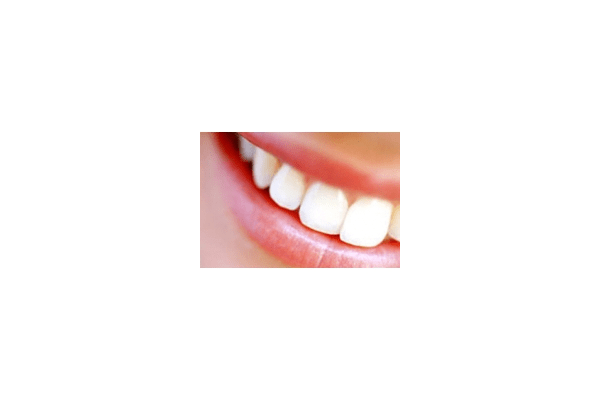 Художня реставрація зубів - NaVolyni.com