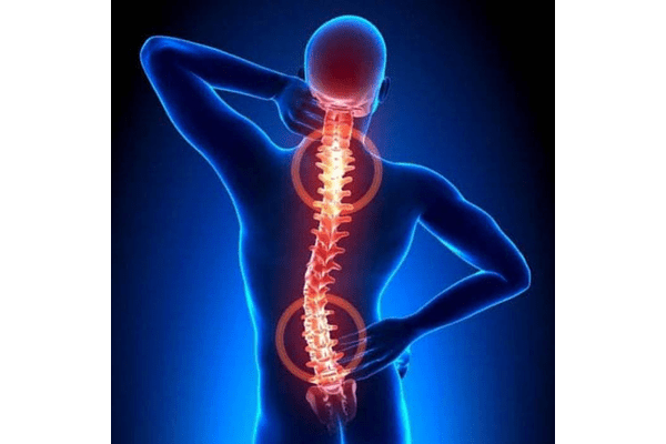 Лікування болю в спині - NaVolyni.com