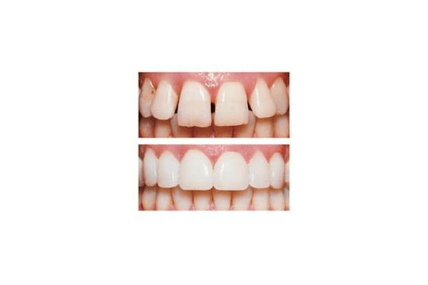 Лікування зубів - NaVolyni.com